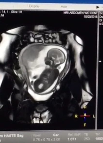 2016_10_22_mri_sam
