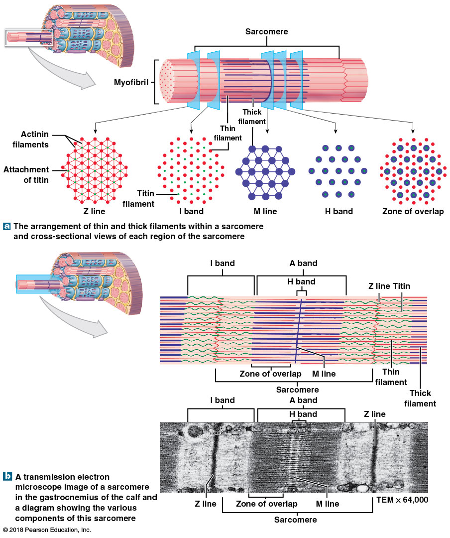 figure_09_04_labeled